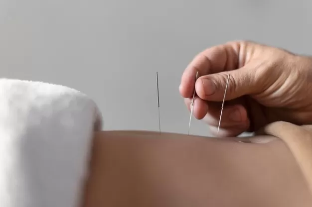 Helpful Advice For Those Interested In Acupuncture - MultiTechGuru